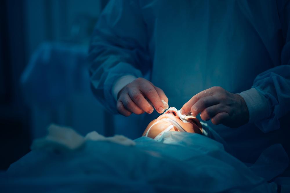 septoplasty