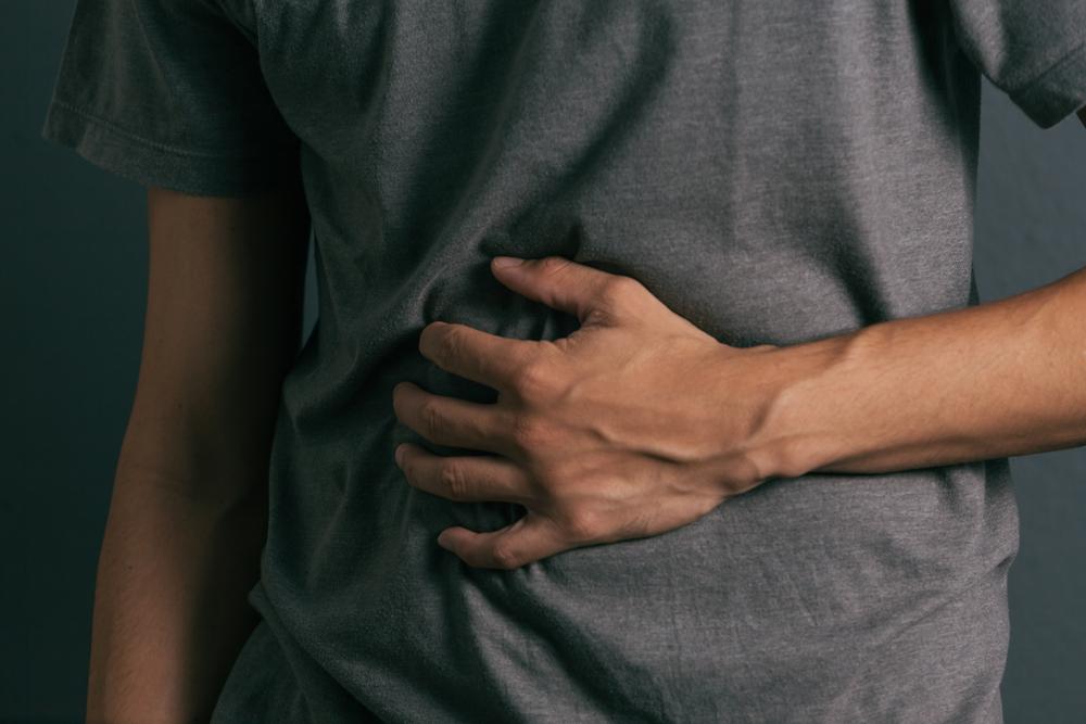 Perforasi Lambung