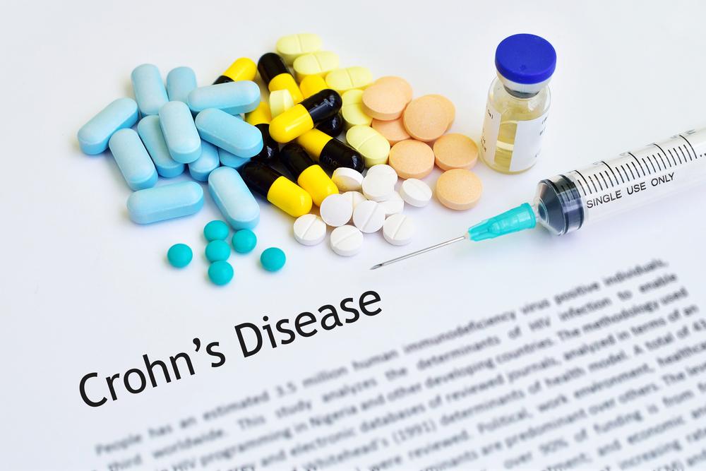apa-itu-penyakit-crohn