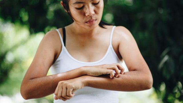 Dermatitis Kontak