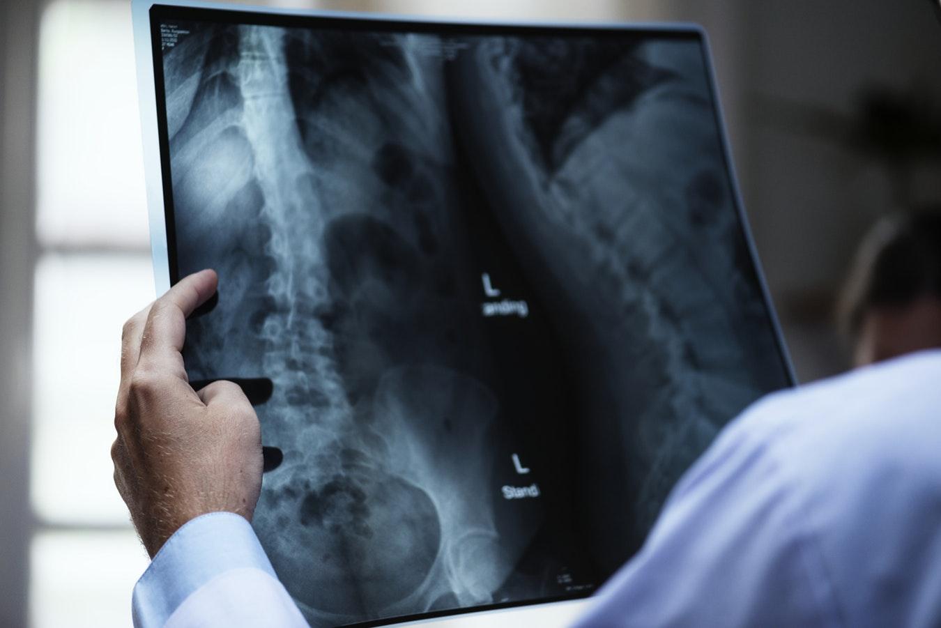 ct-scan-lumbar