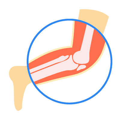 Kesehatan Muskuloskeletal