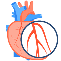 Penyakit Jantung Koroner