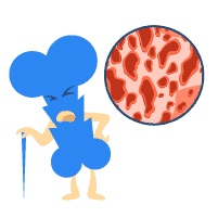 Osteoporosis