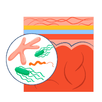 Meningitis