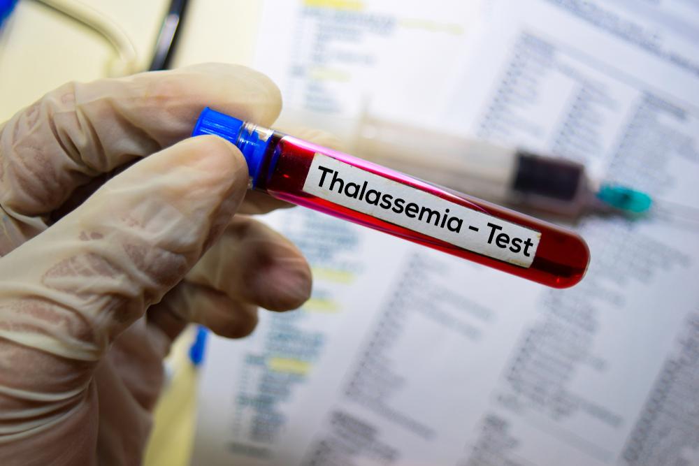 memutus-thalasemia-indonesia