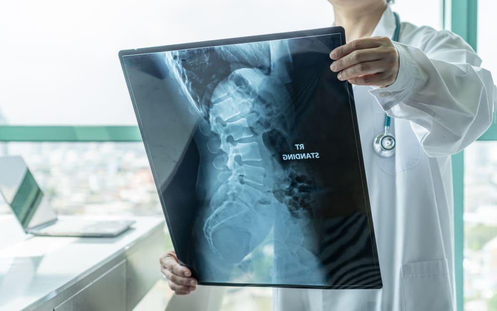 5 Jenis Kanker Tulang dan Cara Mendiagnosis yang Umum Dilakukan