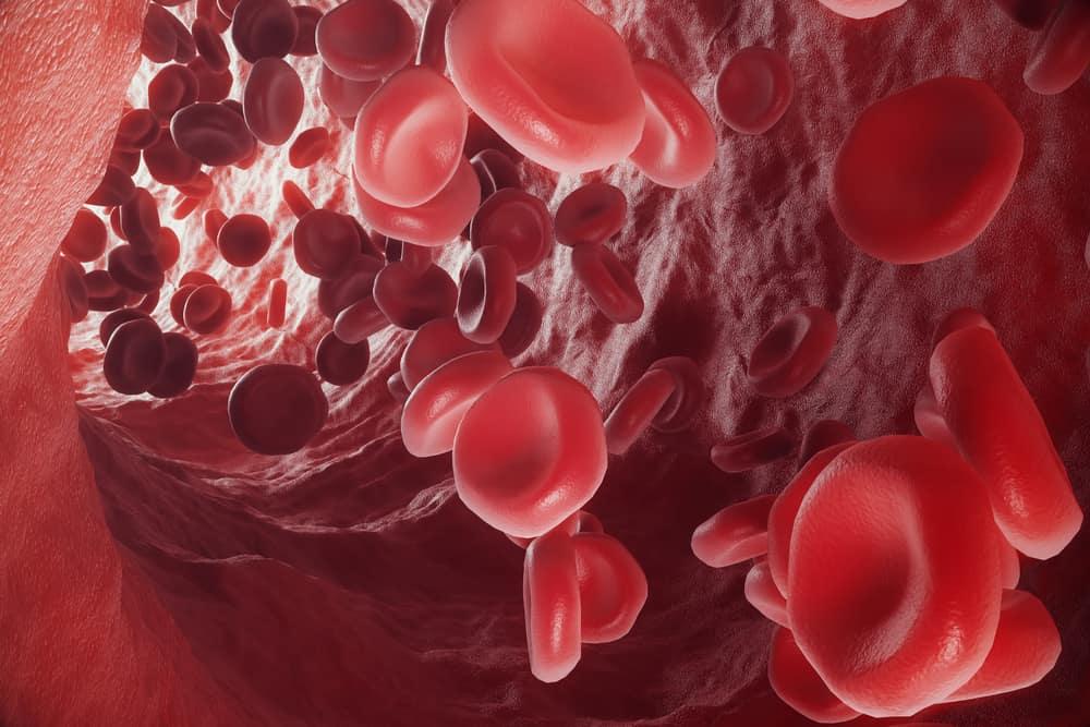 Jumlah Eritrosit di Dalam Tubuh Juga Bisa Tinggi! Ini Beragam Penyebabnya