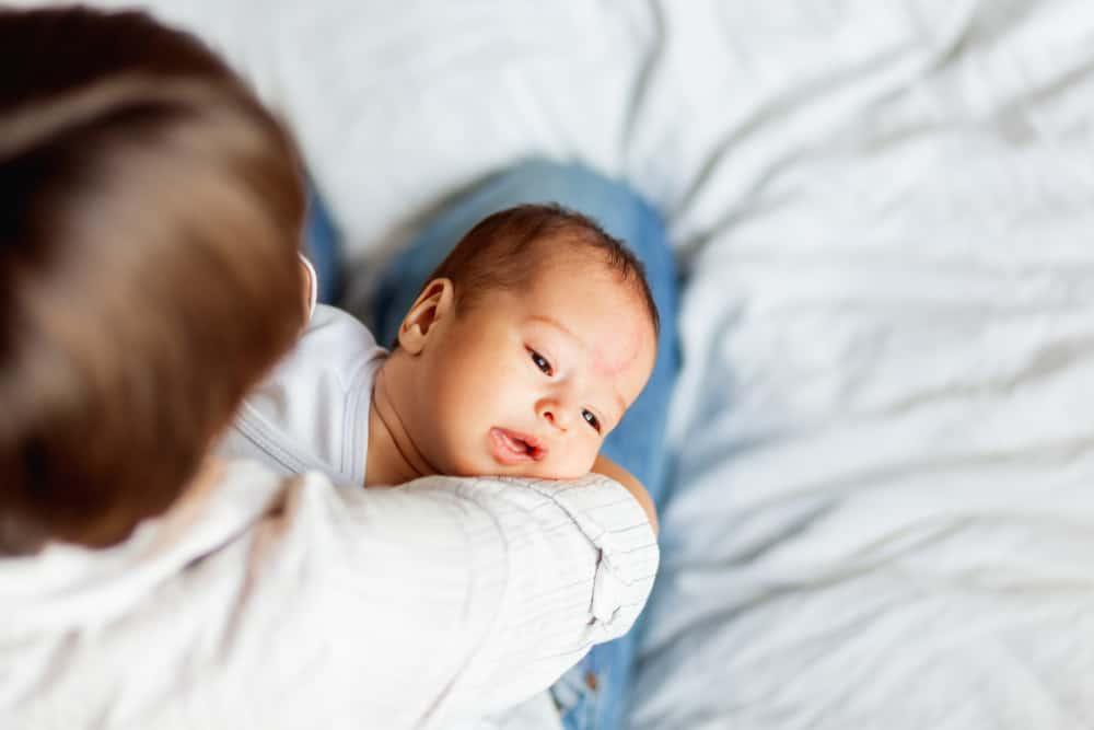 4 Jenis Tanda Lahir yang Berbahaya pada Si Kecil Beserta Cirinya