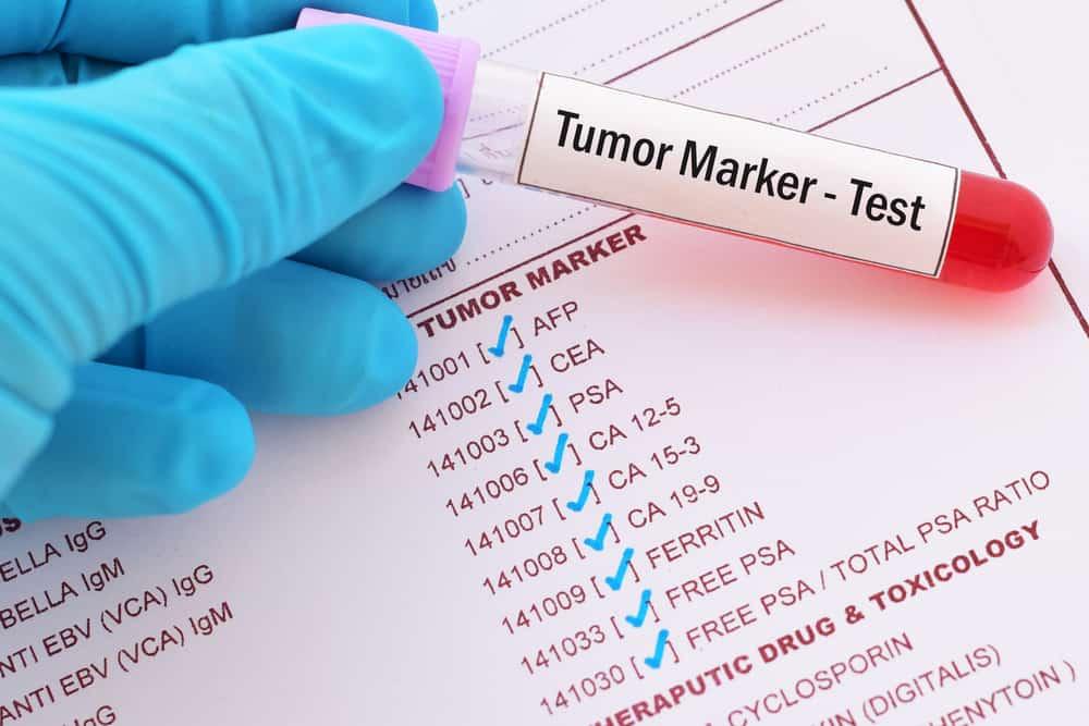 tumor-marker