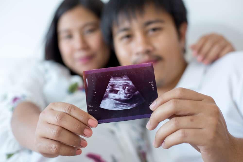 pengalaman-hamil-pcos