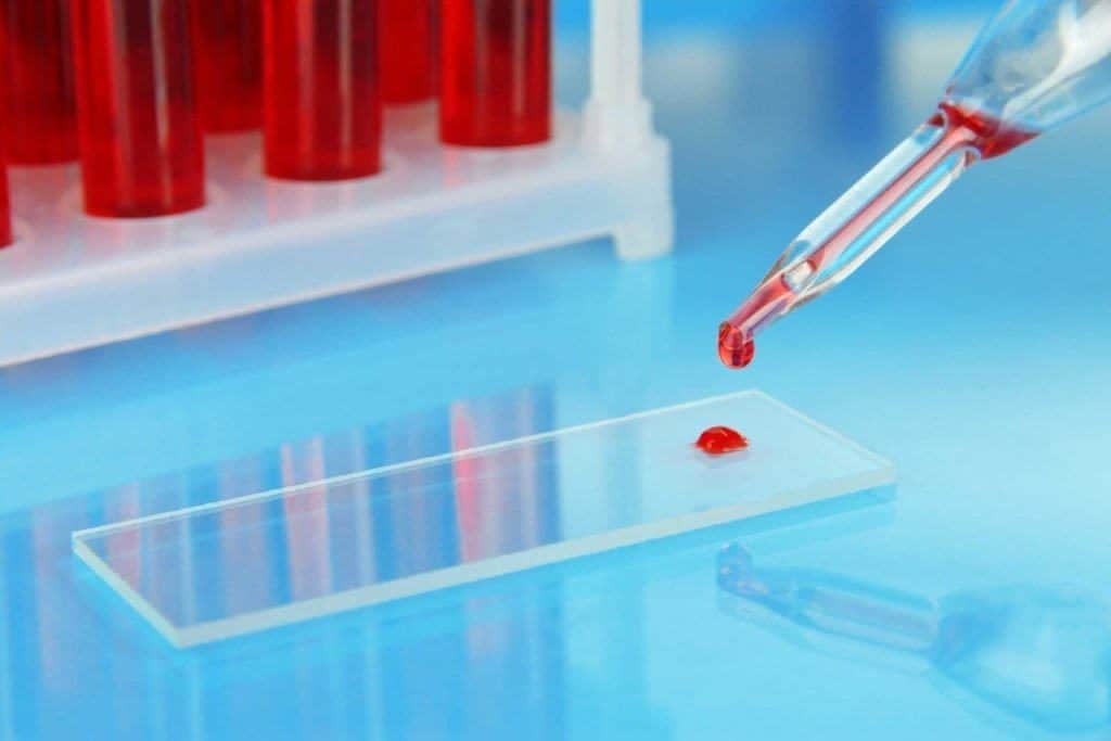 Obat untuk Mengobati Stroke: Antiplatelet Agents