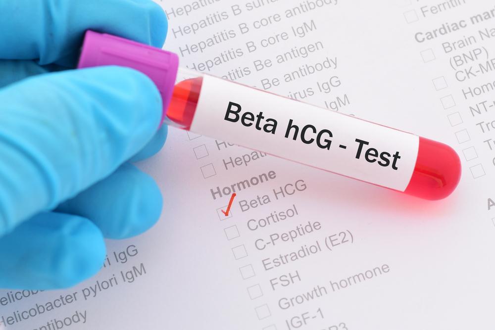 Pemeriksaan Human Chorionic Gonadotropin (hCG) untuk Deteksi Kehamilan