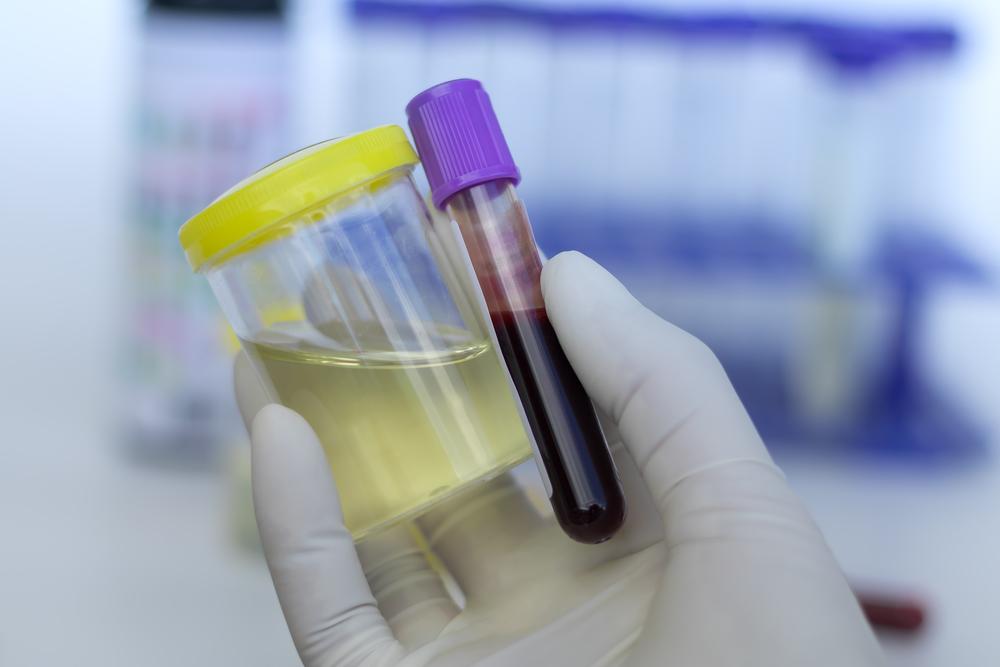 d-xylose-absorption-test