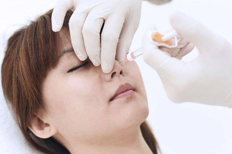 septorhinoplasty
