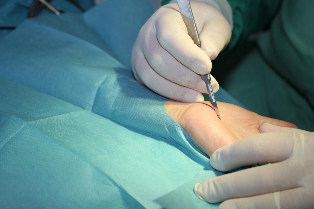 operasi-carpal-tunnel