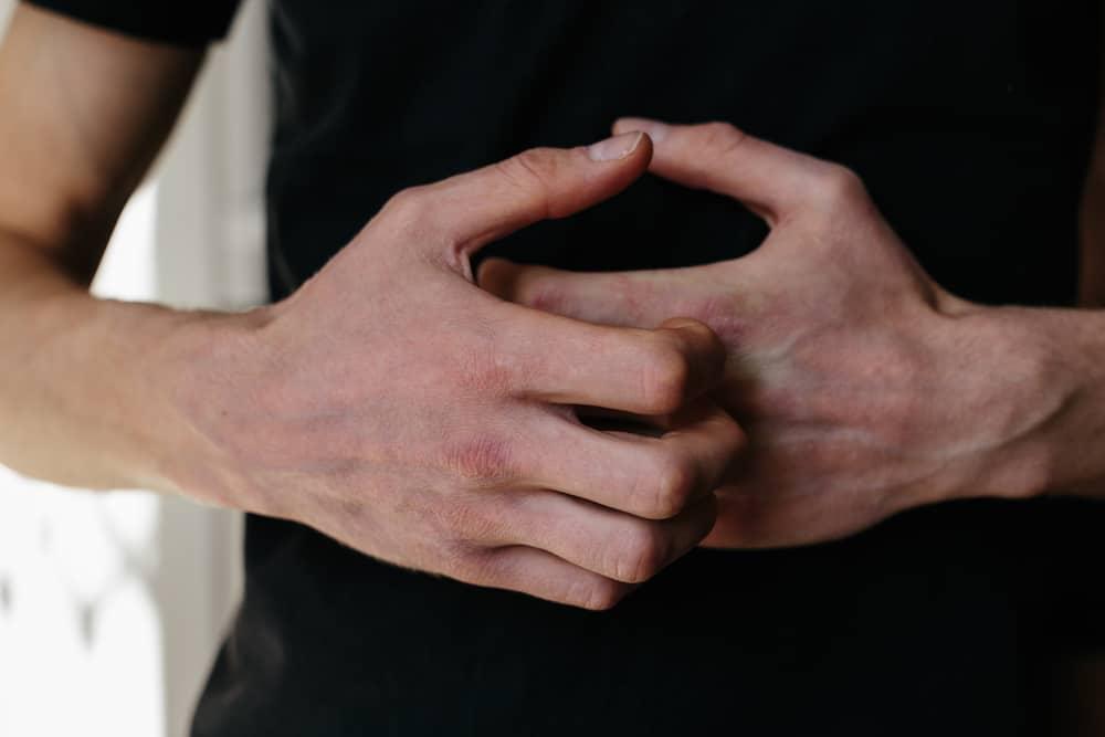 Akantosis Nigrikans, Saat Kulit Menebal dan Menghitam Akibat Diabetes