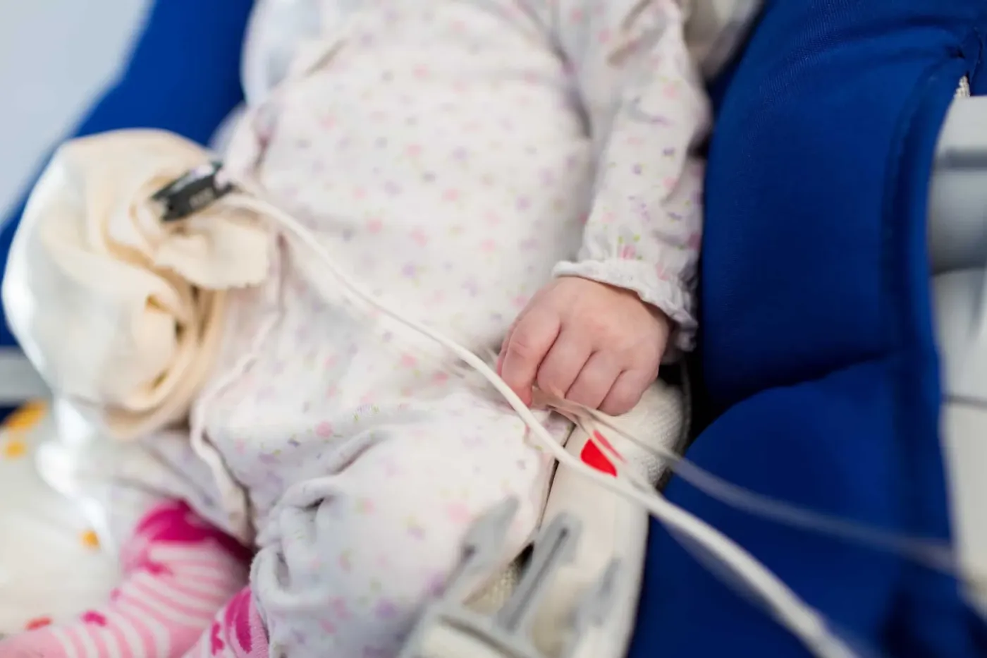 Gastroschisis, Kondisi Saat Bagian Dalam Perut Anak Berada di Luar Tubuh