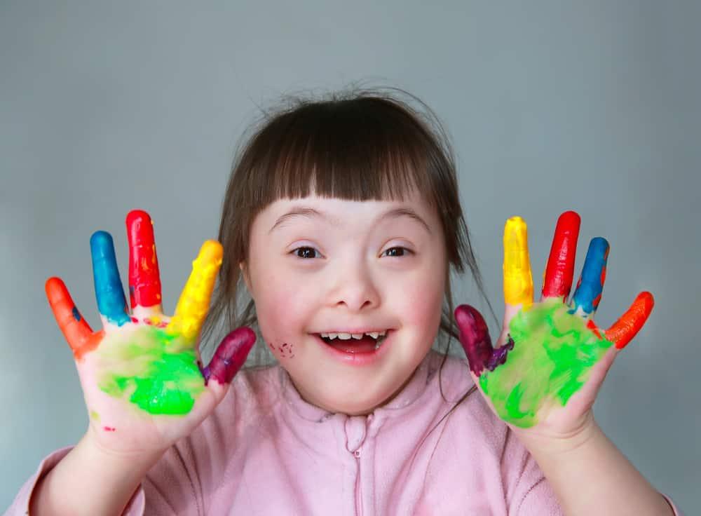 down-syndrome