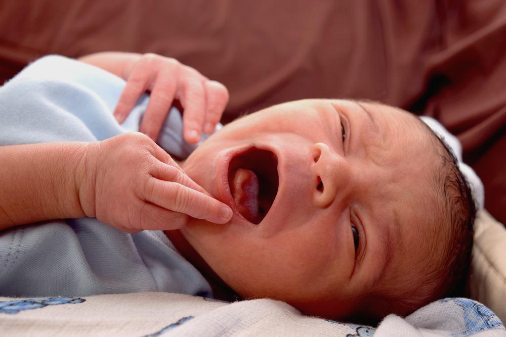 Tongue Tie (Ankyloglossia), Kondisi Saat Gerakan Lidah Bayi Jadi Terbatas