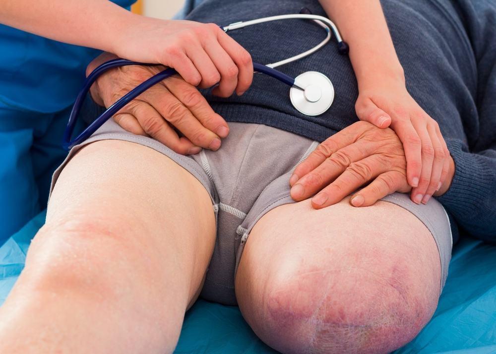 fakta-seputar-amputasi