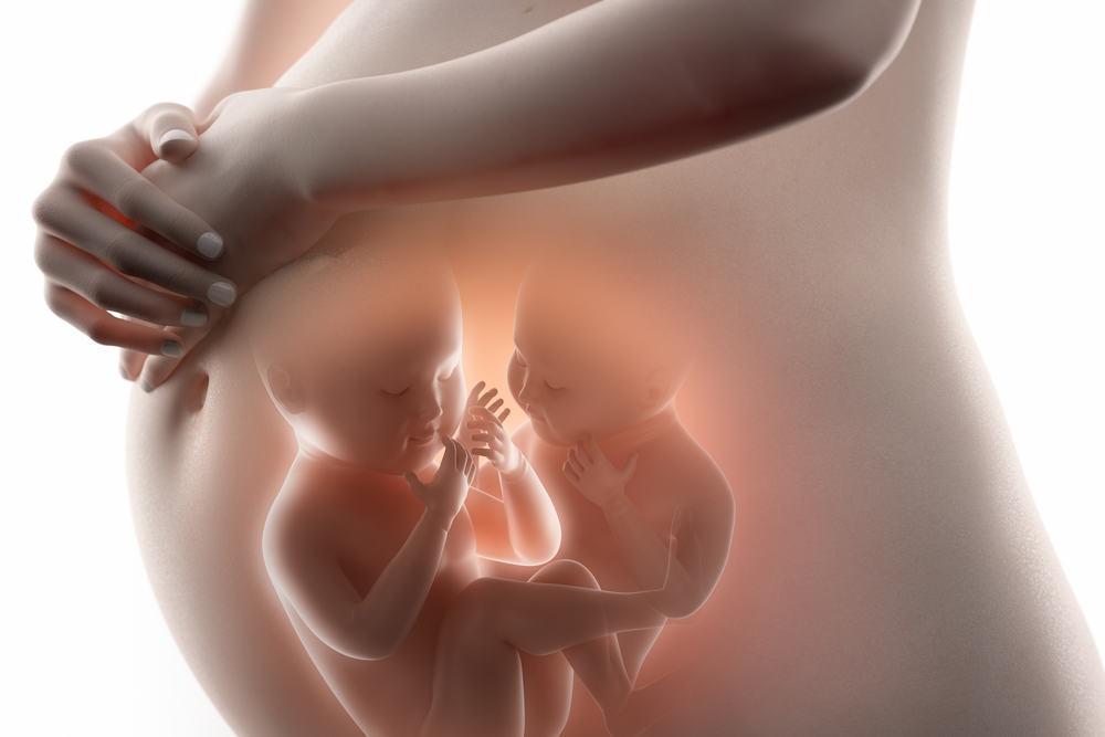 4 Masalah yang Sering Dihadapi Ibu Saat Hamil Anak Kembar