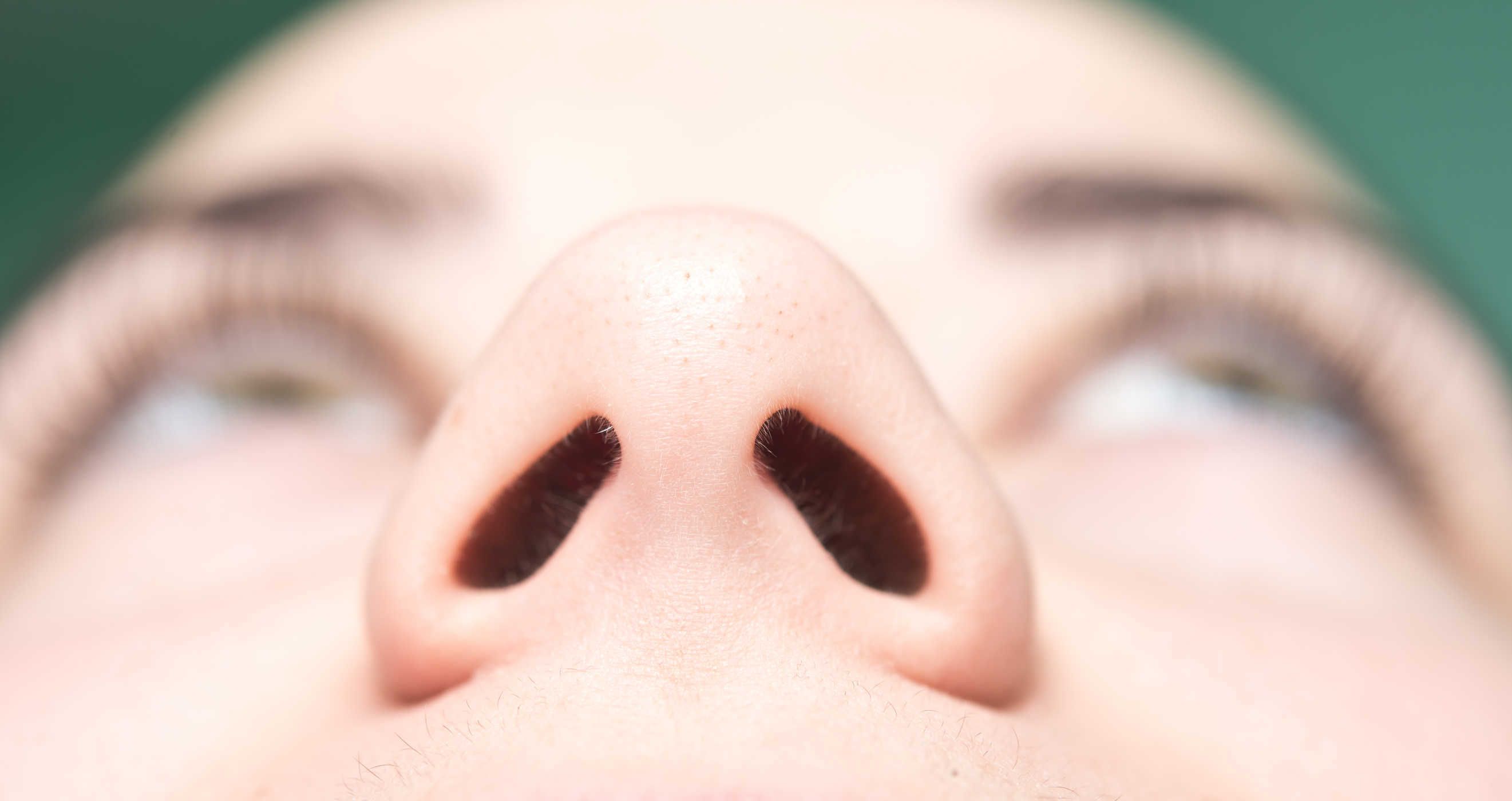 Deviasi Septum Nasal