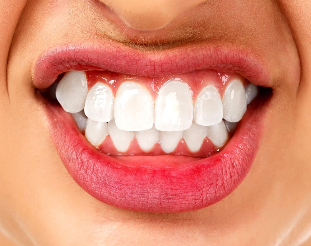 mengenal-bruxism-kebiasaan-menggemeretak-gigi-saat-tidur