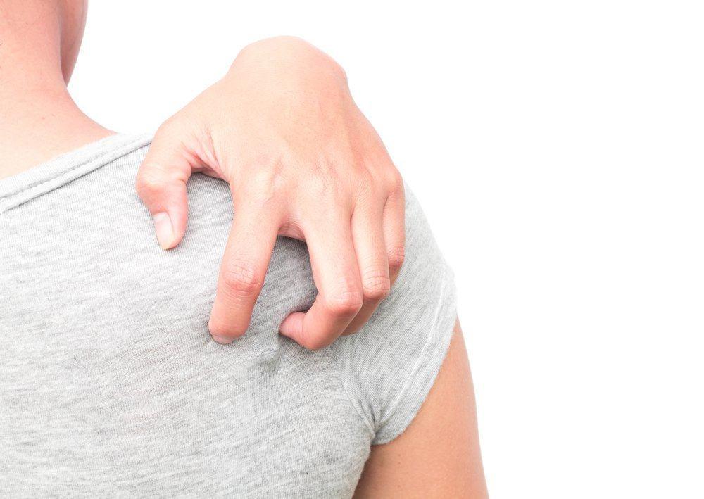 infeksi-jamur-infeksi-tinea