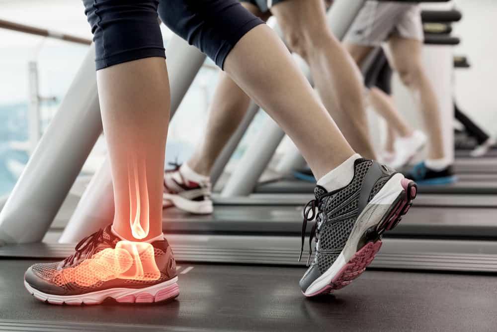 tarsal-tunnel-syndrome