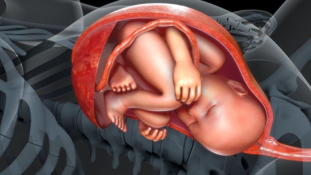 Posisi Bayi Sungsang (Breech Birth) dalam Kandungan, Bisakah Tetap Melahirkan Normal?