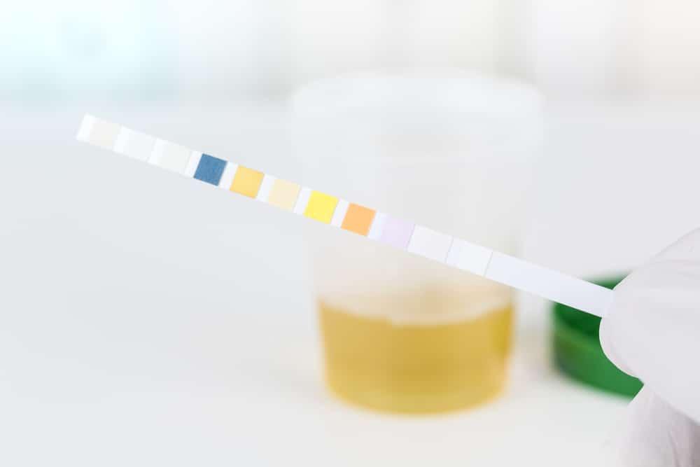 Albuminuria (Ginjal Bocor)