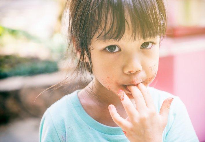 anak-kurang-gizi