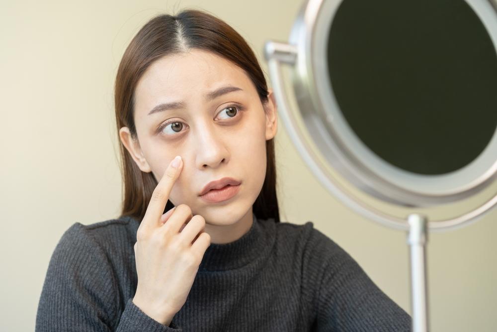 5-penyebab-terbentuknya-kantung-mata