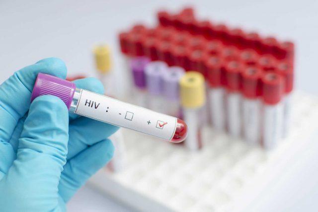 ibu-hiv-boleh-menyusui-atau-tidak