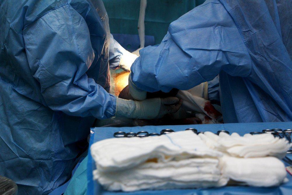 Apakah Episiotomi (Gunting Vagina) Pasti Dilakukan Saat Melahirkan Normal?