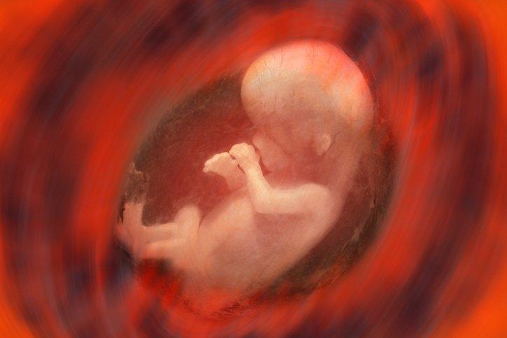 Korioamnionitis, Infeksi Air Ketuban yang Perlu Diwaspadai