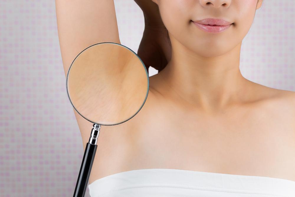 cara-mengatasi-ketiak-hitam