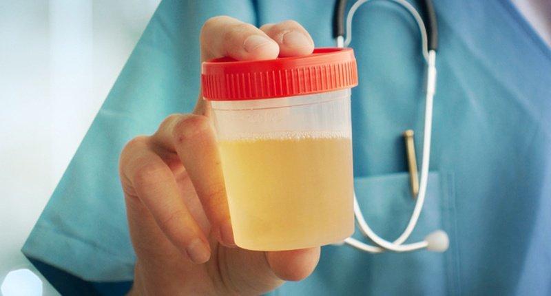 cairan-ketuban-dan-urine