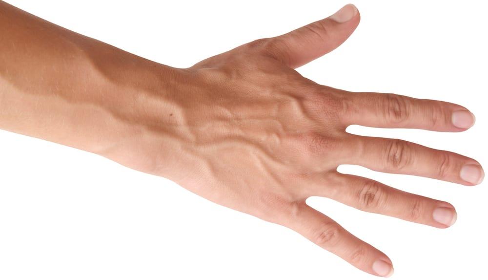 6 Penyebab Urat Anda Menonjol dan Terlihat Jelas di Kulit