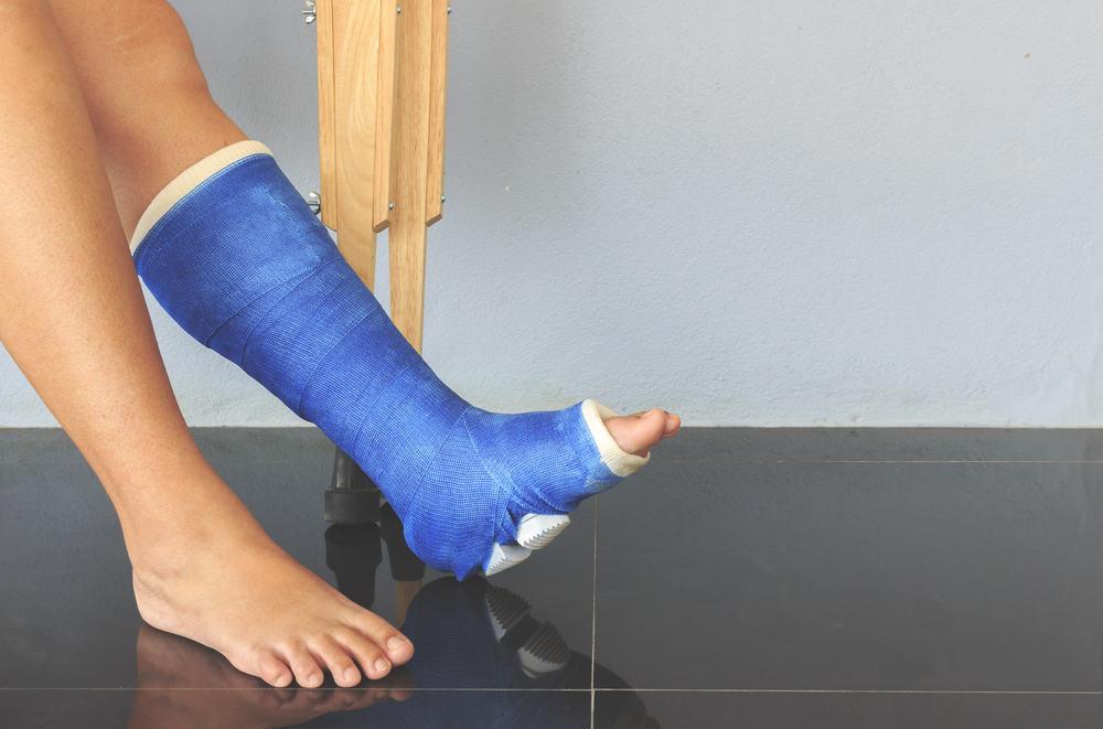 Ini Ciri-ciri yang Akan Terjadi Jika Anda Mengalami Patah Kaki