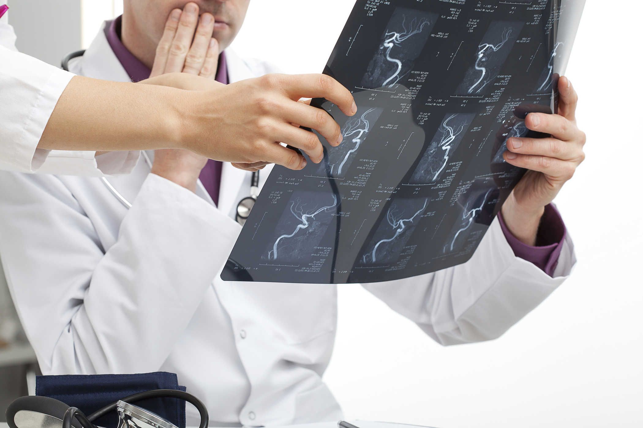 gejala-kerusakan-saraf