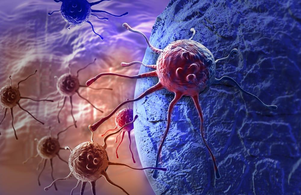 Tumor Tidak Selalu Kanker, Kenali Perbedaannya Berikut Ini