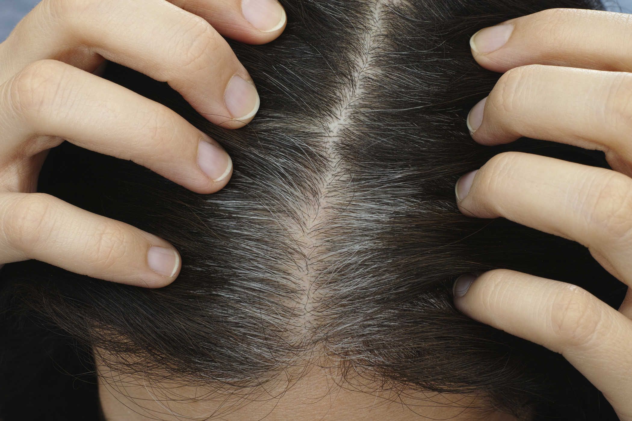 rambut-beruban-tak-di-kepala