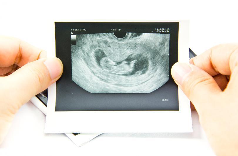 8 Risiko Kesehatan yang Mungkin Terjadi Setelah Aborsi