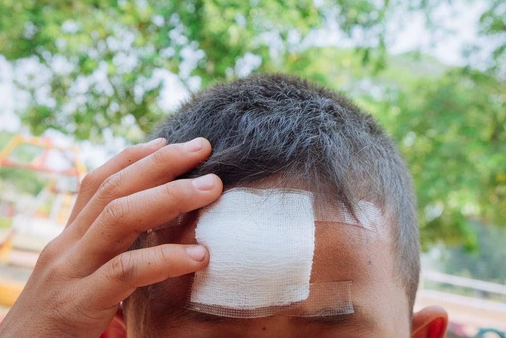Ciri-ciri Gegar Otak yang Perlu Anda Waspadai