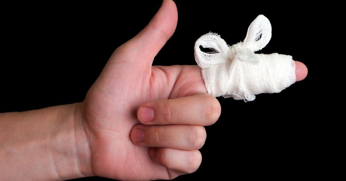 7 Penyebab Jari Bengkak yang Harus Anda Waspadai