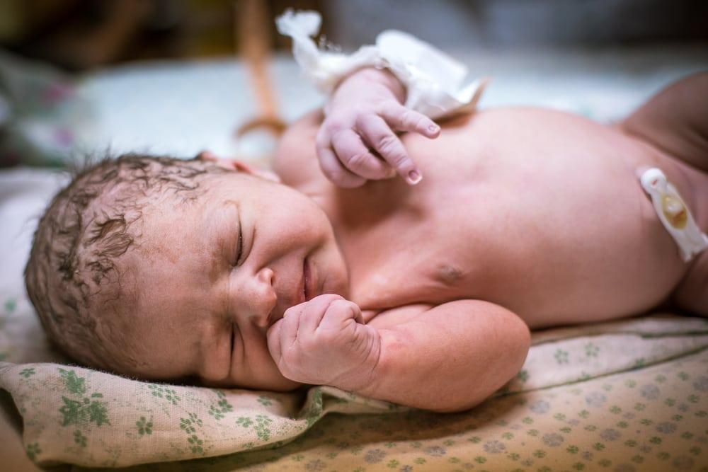 5 Gangguan Kesehatan yang Sering Terjadi Pada Bayi yang Baru Lahir