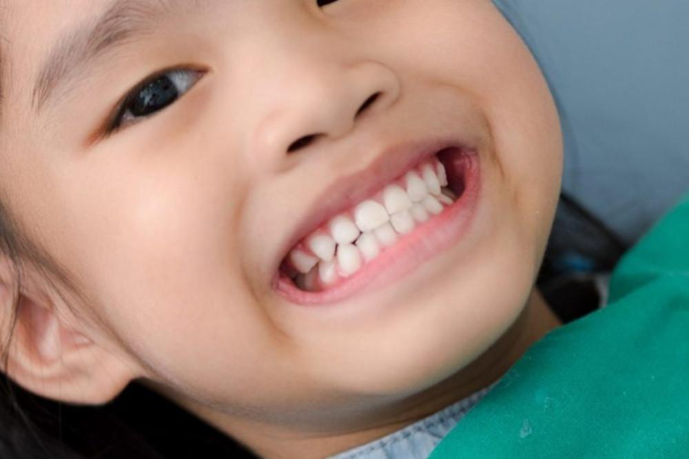 cegah-karies-fluoride-varnish-gigi