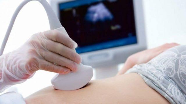 Keguguran Berulang Disebabkan Oleh Faktor Genetik, Mitos Atau Fakta?